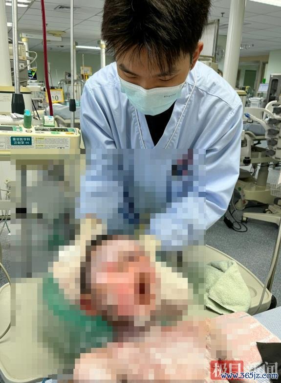9岁男孩全身溃烂 病因竟是常用药 常见退热药激发严重响应